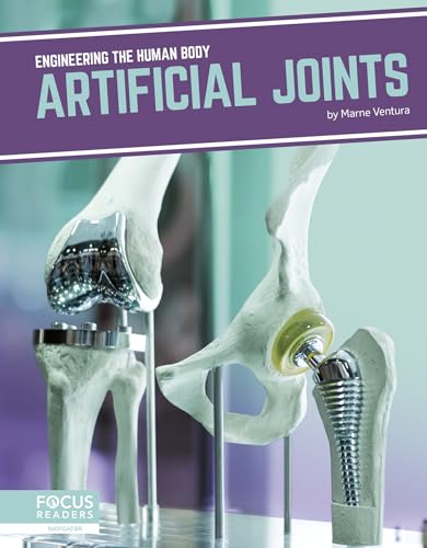 Artificial Joints (Engineering the Human Body)