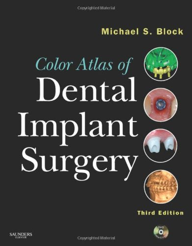 Color Atlas of Dental Implant Surgery