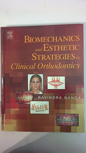 Biomechanics and Esthetic Strategies in Clinical Orthodontics
