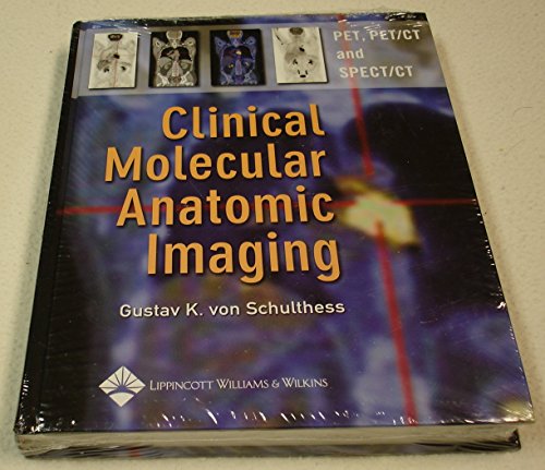 Clinical Molecular Anatomic Imaging: PET, PET/CT, and SPECT/CT